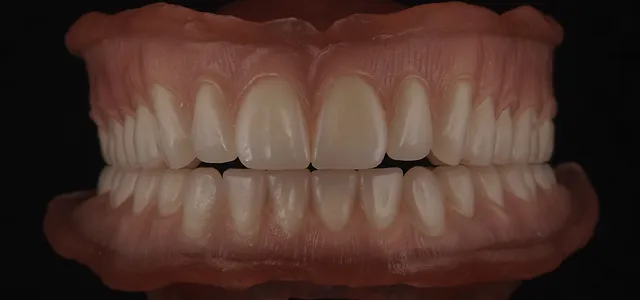 teeth